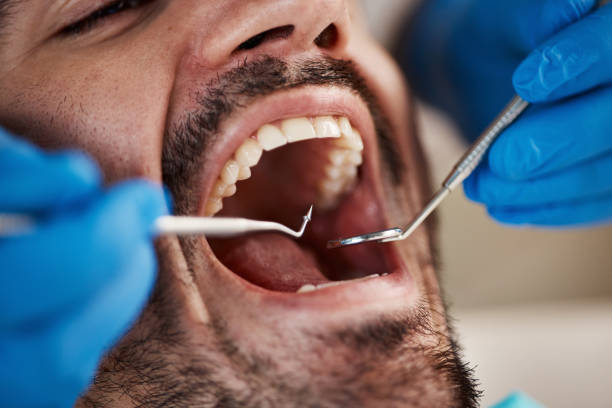 Emergency Dental Services in Portland, IN